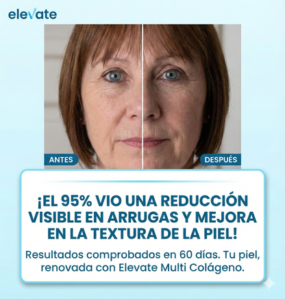 Elevate™: Colágeno Hidrolizado con Vitamina C y Acido hiarulonico ✨